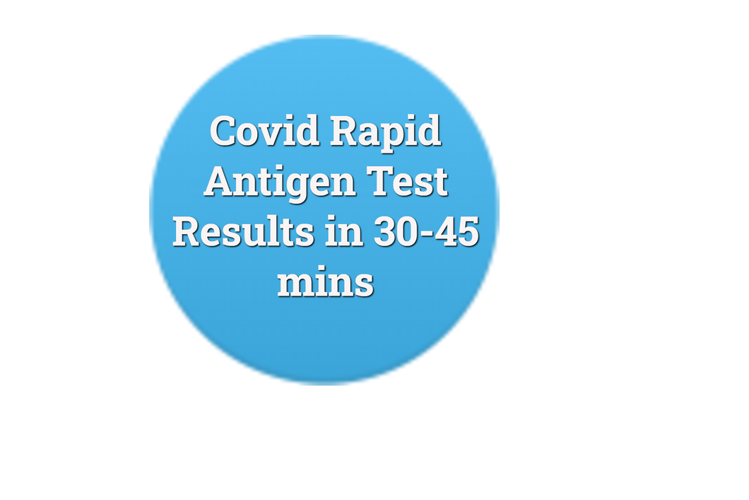 Covid 19 - Rapid Antigen test 30 min results.